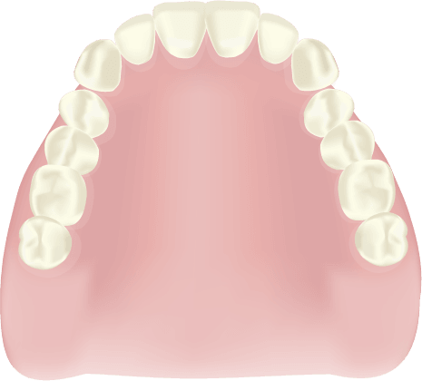 レジン床義歯　総入れ歯